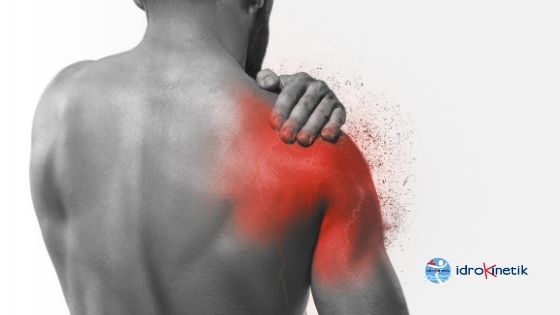 article